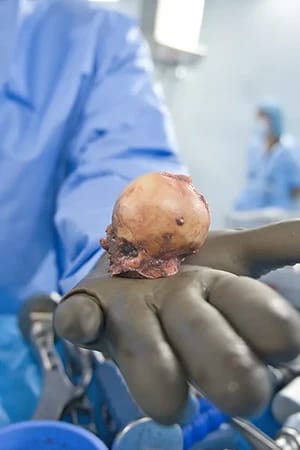 armando mantecon trauma